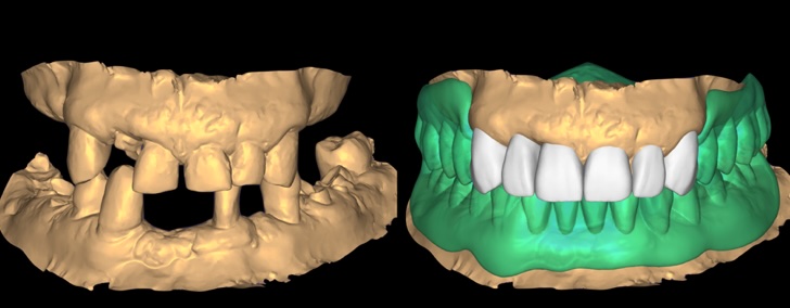 CBCT Imaging and Digital Planning