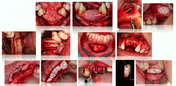 Hard and Soft Tissue Management