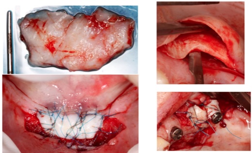 Soft Tissue Management Module